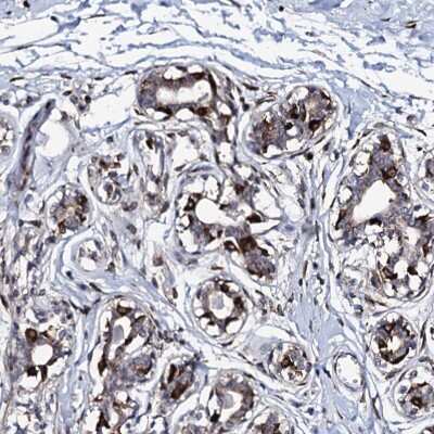 Immunohistochemistry: TMCO3 Antibody [NBP2-48709]