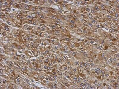 Immunohistochemistry-Paraffin: TMCO3 Antibody [NBP2-20660]