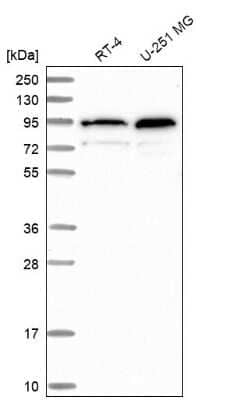 Western Blot: TMCO3 Antibody [NBP2-48709]