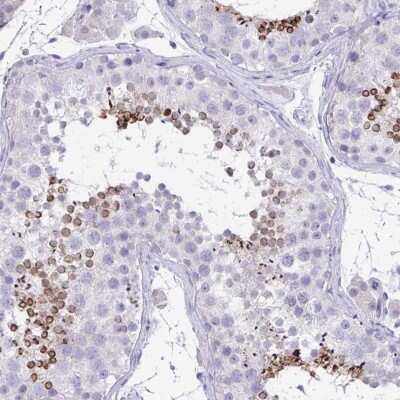 Immunohistochemistry-Paraffin: TMCO5 Antibody [NBP2-34166]