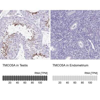 Immunohistochemistry-Paraffin: TMCO5 Antibody [NBP2-34166]