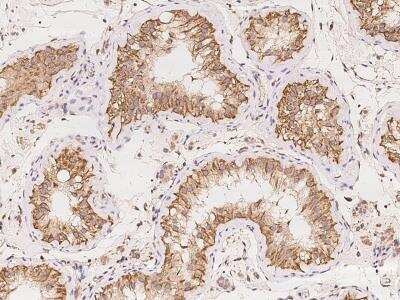 Immunohistochemistry-Paraffin: TMCO5 Antibody [NBP3-06174]