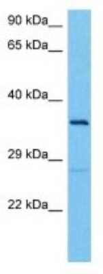 Western Blot: TMCO5B Antibody [NBP3-10235]