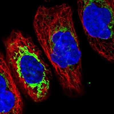 Immunocytochemistry/ Immunofluorescence: TMCO6 Antibody [NBP1-83463]