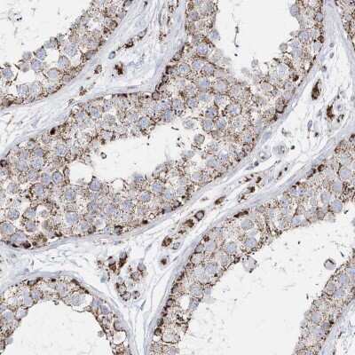 Immunohistochemistry-Paraffin: TMCO6 Antibody [NBP1-83463]