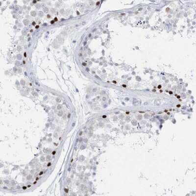 Immunohistochemistry-Paraffin: TMCO6 Antibody [NBP1-83464]