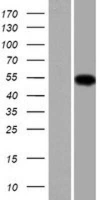 Western Blot: TMCO6 Overexpression Lysate [NBP2-06790]