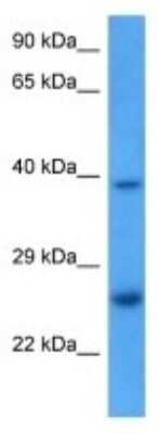 Western Blot: TMED1 Antibody [NBP3-09998]