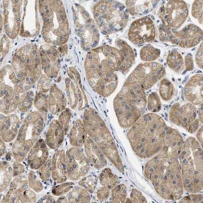 Immunohistochemistry-Paraffin: TMED1 Antibody [NBP1-81595]