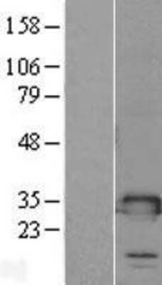 Western Blot: TMED1 Overexpression Lysate [NBL1-16979]