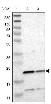 Western Blot: TMED2 Antibody [NBP1-80963]