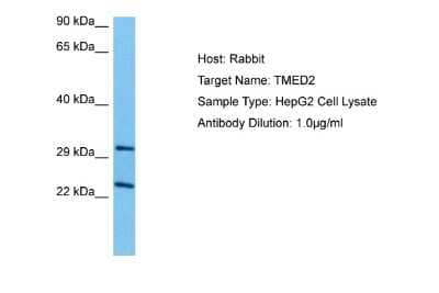 Western Blot: TMED2 Antibody [NBP2-83663]