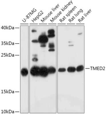 Western Blot: TMED2 AntibodyAzide and BSA Free [NBP2-94067]