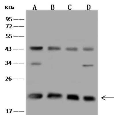 Western Blot: TMED2 Antibody [NBP3-06498]