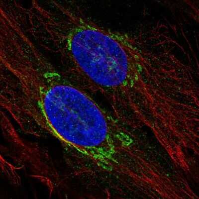 Immunocytochemistry/ Immunofluorescence: TMED3 Antibody [NBP2-57648]
