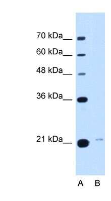 Western Blot: TMED3 Antibody [NBP1-62563]