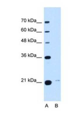 Western Blot: TMED3 Antibody [NBP1-69575]