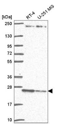 Western Blot: TMED3 Antibody [NBP2-57648]