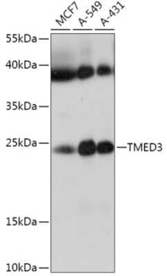 Western Blot: TMED3 AntibodyAzide and BSA Free [NBP2-94321]