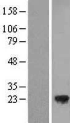 Western Blot: TMED3 Overexpression Lysate [NBL1-16982]