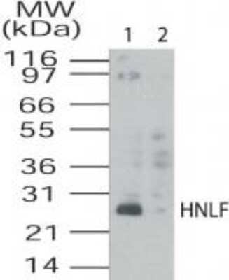 Western Blot: TMED4 Antibody [NB100-56393]