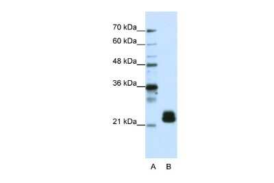 Western Blot: TMED4 Antibody [NBP2-84303]