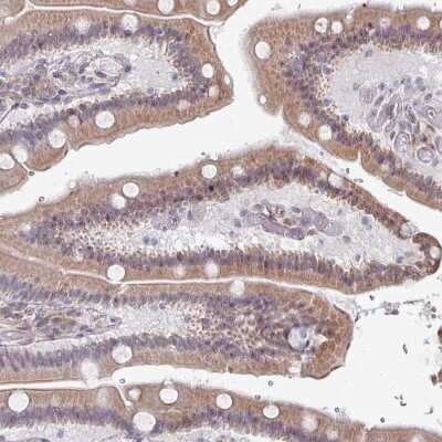 Immunohistochemistry-Paraffin: TMED5 Antibody [NBP2-13440]