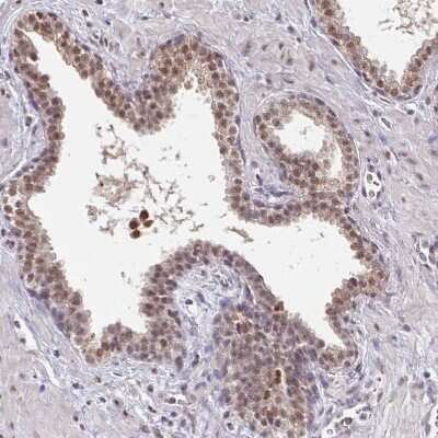 Immunohistochemistry-Paraffin: TMED5 Antibody [NBP2-13440]