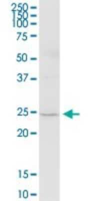 Western Blot: TMED5 Antibody [H00050999-B01P]