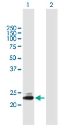 Western Blot: TMED5 Antibody [H00050999-B01P]