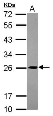 Western Blot: TMED5 Antibody [NBP2-20662]