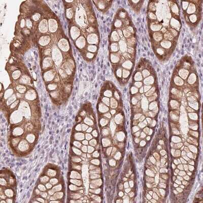 Immunohistochemistry-Paraffin: TMED6 Antibody [NBP1-81161]
