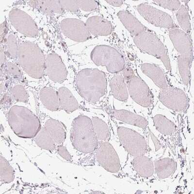 Immunohistochemistry-Paraffin: TMED6 Antibody [NBP1-81161]