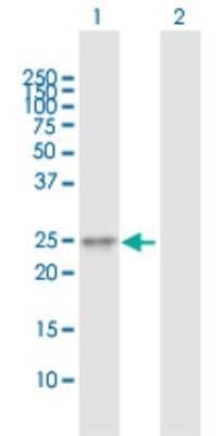 Western Blot: TMED6 Antibody [H00146456-B01P]