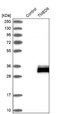 Western Blot: TMED6 Antibody [NBP1-81161]