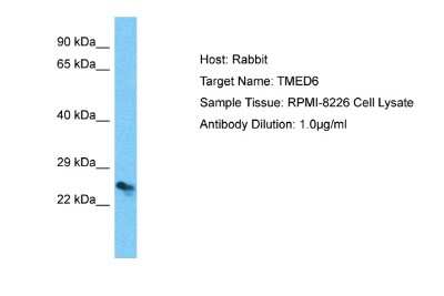 Western Blot: TMED6 Antibody [NBP2-85933]