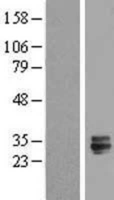 Western Blot: TMED6 Overexpression Lysate [NBL1-16984]