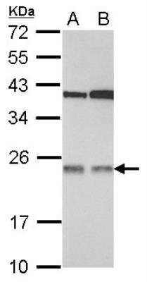 Western Blot: TMED7 Antibody [NBP2-15141]