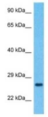 Western Blot: TMED7 Antibody [NBP3-09969]