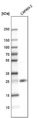 Western Blot: TMED7 Antibody [NBP1-90949]