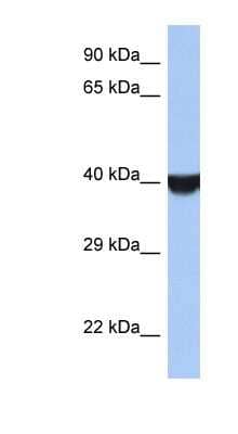 Western Blot: TMED8 Antibody [NBP1-55452]