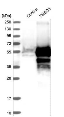 Western Blot: TMED8 Antibody [NBP1-84744]