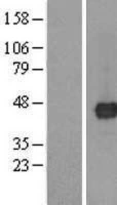 Western Blot: TMED8 Overexpression Lysate [NBL1-16985]