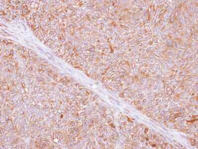 Immunohistochemistry-Paraffin: TMED9 Antibody [NBP1-31650]