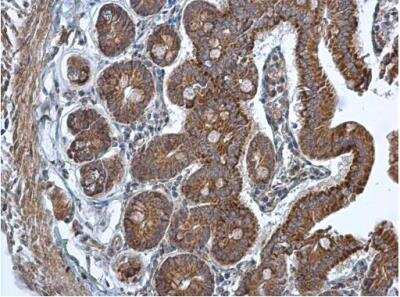 Immunohistochemistry-Paraffin: TMED9 Antibody [NBP1-31650]