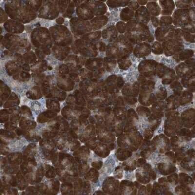 Immunohistochemistry-Paraffin: TMED9 Antibody [NBP1-83193]