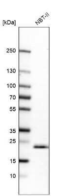 Western Blot: TMED9 Antibody [NBP1-83193]