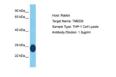 Western Blot: TMED9 Antibody [NBP2-85935]