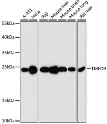 Western Blot: TMED9 AntibodyAzide and BSA Free [NBP2-94854]