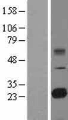 Western Blot: TMED9 Overexpression Lysate [NBL1-16986]